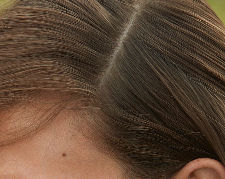 Moins de chute de cheveux, plus de naturalité !